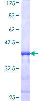 PRKAB2 / AMPK Beta 2 Protein - 12.5% SDS-PAGE Stained with Coomassie Blue.