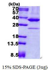 PRKAB2 / AMPK Beta 2 Protein