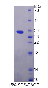 PRKAB2 / AMPK Beta 2 Protein - Recombinant  Protein Kinase, AMP Activated Beta 2 By SDS-PAGE