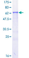 PRKACA Protein - 12.5% SDS-PAGE of human PRKACA stained with Coomassie Blue