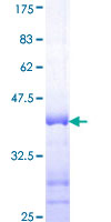 PRKACA Protein - 12.5% SDS-PAGE Stained with Coomassie Blue.