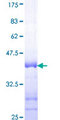 PRKACA Protein - 12.5% SDS-PAGE Stained with Coomassie Blue.