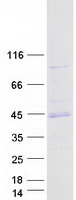 PRKACA Protein - Purified recombinant protein PRKACA was analyzed by SDS-PAGE gel and Coomassie Blue Staining