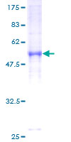 PRKACB Protein - 12.5% SDS-PAGE of human PRKACB stained with Coomassie Blue