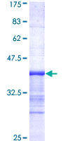 PRKACB Protein - 12.5% SDS-PAGE Stained with Coomassie Blue.