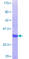 PRKACG Protein - 12.5% SDS-PAGE Stained with Coomassie Blue.