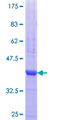 PRKACG Protein - 12.5% SDS-PAGE Stained with Coomassie Blue.