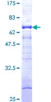 PRKAG1 / AMPK Gamma 1 Protein - 12.5% SDS-PAGE of human PRKAG1 stained with Coomassie Blue