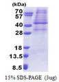 PRKAG1 / AMPK Gamma 1 Protein