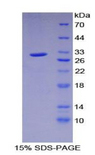 PRKAG1 / AMPK Gamma 1 Protein - Recombinant Protein Kinase, AMP Activated Gamma 1 By SDS-PAGE