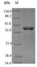 PRKAG2 / AMPK Gamma 2 Protein - (Tris-Glycine gel) Discontinuous SDS-PAGE (reduced) with 5% enrichment gel and 15% separation gel.