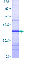 PRKAG2 / AMPK Gamma 2 Protein - 12.5% SDS-PAGE Stained with Coomassie Blue.