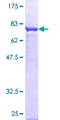PRKAR1A Protein - 12.5% SDS-PAGE of human PRKAR1A stained with Coomassie Blue