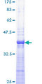 PRKAR1A Protein - 12.5% SDS-PAGE Stained with Coomassie Blue.