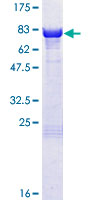 PRKAR1B Protein - 12.5% SDS-PAGE of human PRKAR1B stained with Coomassie Blue