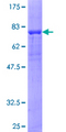 PRKAR2A Protein - 12.5% SDS-PAGE of human PRKAR2A stained with Coomassie Blue