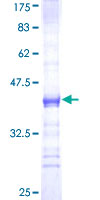 PRKAR2A Protein - 12.5% SDS-PAGE Stained with Coomassie Blue.