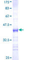 PRKAR2A Protein - 12.5% SDS-PAGE Stained with Coomassie Blue.