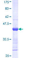 PRKAR2B Protein - 12.5% SDS-PAGE Stained with Coomassie Blue.