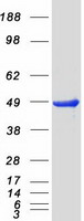 PRKAR2B Protein - Purified recombinant protein PRKAR2B was analyzed by SDS-PAGE gel and Coomassie Blue Staining