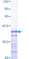 PRKCA / PKC-Alpha Protein - 12.5% SDS-PAGE Stained with Coomassie Blue.