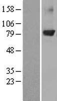 PRKCB / PKC-Beta Protein - Western validation with an anti-DDK antibody * L: Control HEK293 lysate R: Over-expression lysate