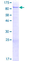 PRKCB / PKC-Beta Protein - 12.5% SDS-PAGE of human PRKCB1 stained with Coomassie Blue