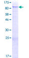 PRKCB / PKC-Beta Protein - 12.5% SDS-PAGE of human PRKCB1 stained with Coomassie Blue