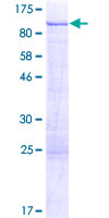 PRKCD / PKC-Delta Protein - 12.5% SDS-PAGE of human PRKCD stained with Coomassie Blue