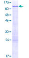 PRKCD / PKC-Delta Protein - 12.5% SDS-PAGE of human PRKCD stained with Coomassie Blue