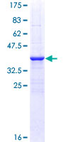 PRKCD / PKC-Delta Protein - 12.5% SDS-PAGE Stained with Coomassie Blue.