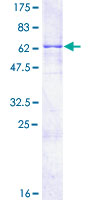 PRKCDBP / CAVIN3 Protein - 12.5% SDS-PAGE of human PRKCDBP stained with Coomassie Blue