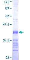 PRKCG / PKC-Gamma Protein - 12.5% SDS-PAGE Stained with Coomassie Blue.