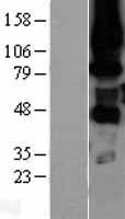 PRKCH / PKC-Eta Protein - Western validation with an anti-DDK antibody * L: Control HEK293 lysate R: Over-expression lysate