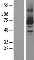 PRKCI / PKC Iota Protein - Western validation with an anti-DDK antibody * L: Control HEK293 lysate R: Over-expression lysate