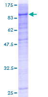 PRKCI / PKC Iota Protein - 12.5% SDS-PAGE of human PRKCI stained with Coomassie Blue