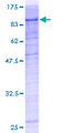 PRKCI / PKC Iota Protein - 12.5% SDS-PAGE of human PRKCI stained with Coomassie Blue