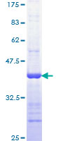 PRKCI / PKC Iota Protein - 12.5% SDS-PAGE Stained with Coomassie Blue.