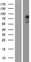 PRKCQ / PKC-Theta Protein - Western validation with an anti-DDK antibody * L: Control HEK293 lysate R: Over-expression lysate