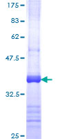 PRKCQ / PKC-Theta Protein - 12.5% SDS-PAGE Stained with Coomassie Blue.