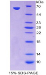 PRKCQ / PKC-Theta Protein - Recombinant  Protein Kinase C Theta By SDS-PAGE