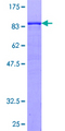PRKCSH Protein - 12.5% SDS-PAGE of human PRKCSH stained with Coomassie Blue