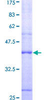 PRKCSH Protein - 12.5% SDS-PAGE Stained with Coomassie Blue.