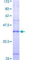 PRKCSH Protein - 12.5% SDS-PAGE Stained with Coomassie Blue.