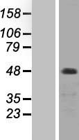 PRKCZ / PKC-Zeta Protein - Western validation with an anti-DDK antibody * L: Control HEK293 lysate R: Over-expression lysate