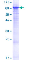 PRKCZ / PKC-Zeta Protein - 12.5% SDS-PAGE of human PRKCZ stained with Coomassie Blue