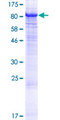 PRKCZ / PKC-Zeta Protein - 12.5% SDS-PAGE of human PRKCZ stained with Coomassie Blue