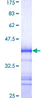 PRKCZ / PKC-Zeta Protein - 12.5% SDS-PAGE Stained with Coomassie Blue.
