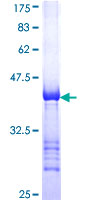 PRKD1 / PKC Mu Protein - 12.5% SDS-PAGE Stained with Coomassie Blue.