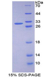 PRKD1 / PKC Mu Protein - Recombinant Protein Kinase D1 By SDS-PAGE